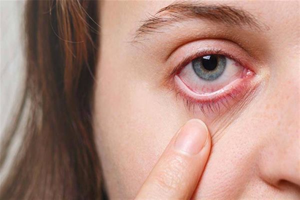 للوقاية من العمى الدائم... إنتبهوا لهذا الأمر!