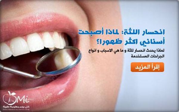 انحسار اللثة: لماذا أصبحت أسناني اكثر ظهورا؟