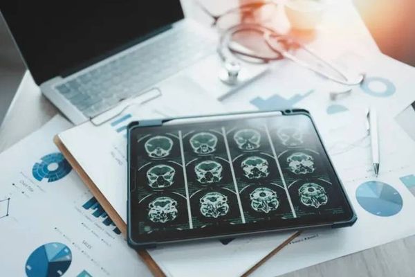 دراسة حديثة تظهر العلاقة بين تغيّر المناخ وحجم الدماغ... إليكم التفاصيل