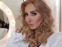 جويل ماردينيان قبل وبعد التجميل .. لن تصدّقوا!
