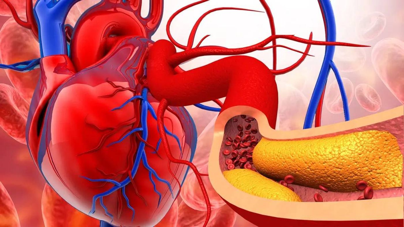 كيف يحمي التشخيص المبكر من تصلب الشرايين؟