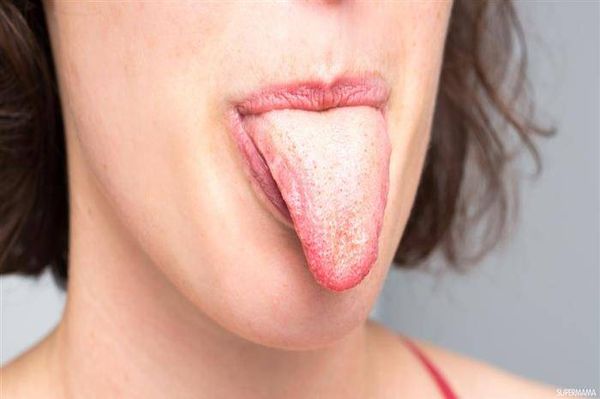 البياض على اللسان: ما هي الرسالة التي يحملها؟