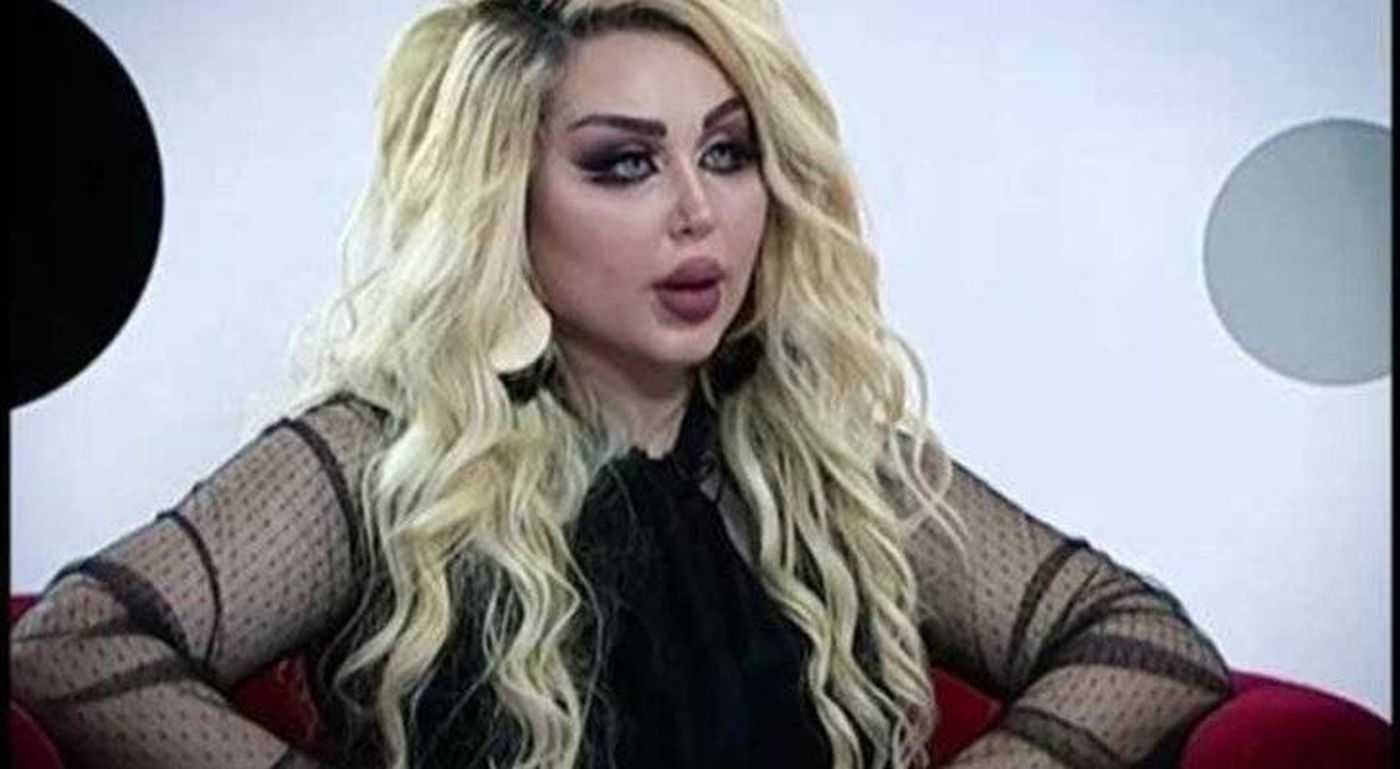 بالصورة- داليا نعيم تصدم المتابعين!