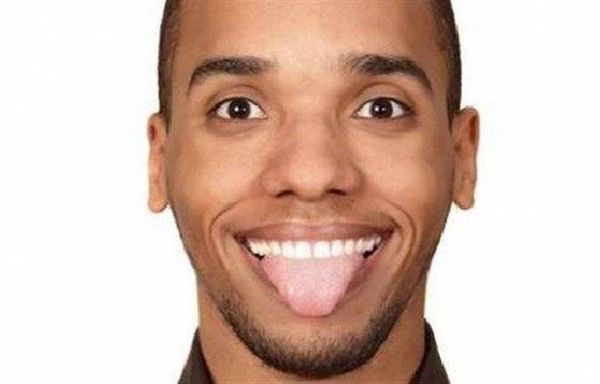 لماذا يصبح اللسان أبيض؟