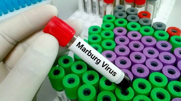 مدير منظمة الصحة العالمية لإقليم شرق المتوسط: مخاطر انتشار مرض فيروس ماربورغ عالميا منخفضة حالياً