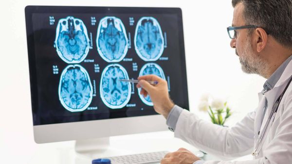 التهاب الدماغ: الأسباب المختلفة وتأثيراتها الصحيّة