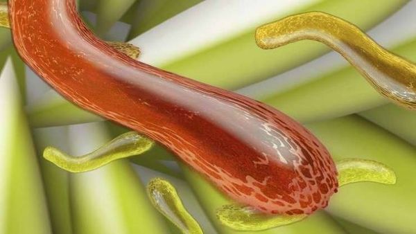 الأطباء يحذرون من 'سوبر بكتيريا' تسبب العقم