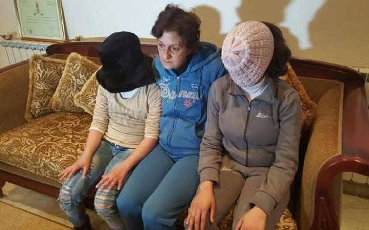 أب حرق ابنتيه بشيش حديد