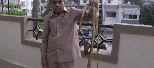 أخيراً صاحب أطول أظافر بالعالم يقرر تقليمها