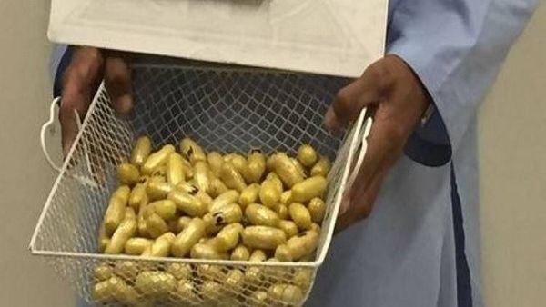 إحباط تهريب هيروين داخل أحشاء مسافر في السعودية