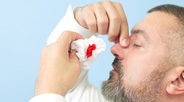عند نزيف الانف... اليكم التصرف الامثل لإيقافه