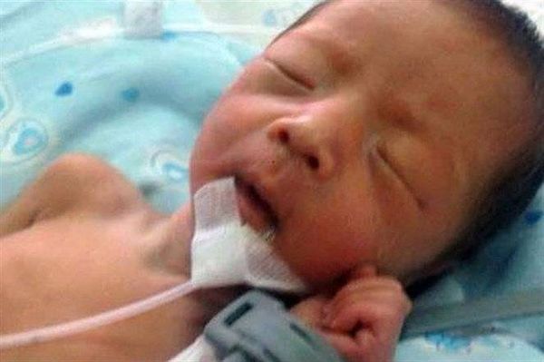 طفلة تعود للحياة بعد ساعتين على دفنها