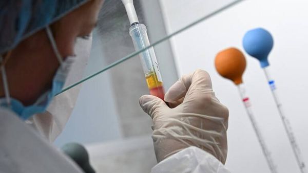 المعهد الروسي لأبحاث الإنفلونزا يكمل التجربة قبل السريرية للقاح خاص ضد فيروس كورونا