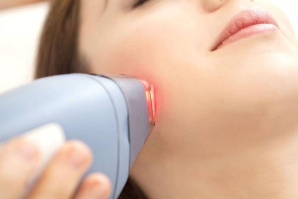 هل إزالة الشعر بالليزر تُسبب السرطان؟
