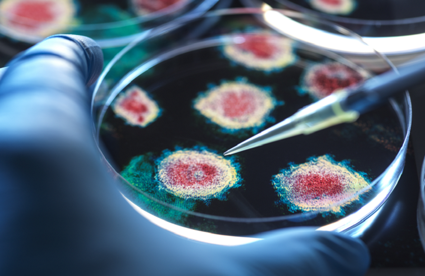 اكتشاف بصمة مناعية يفسر كوفيد طويل الأمد