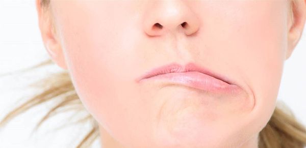 بسبب أزمة نفسية.. فنانة شهيرة تُصاب بمرض العصب السابع في وجهها