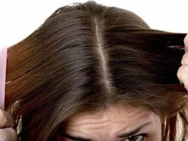 زيت النيم للتخلص من قشرة الرأس