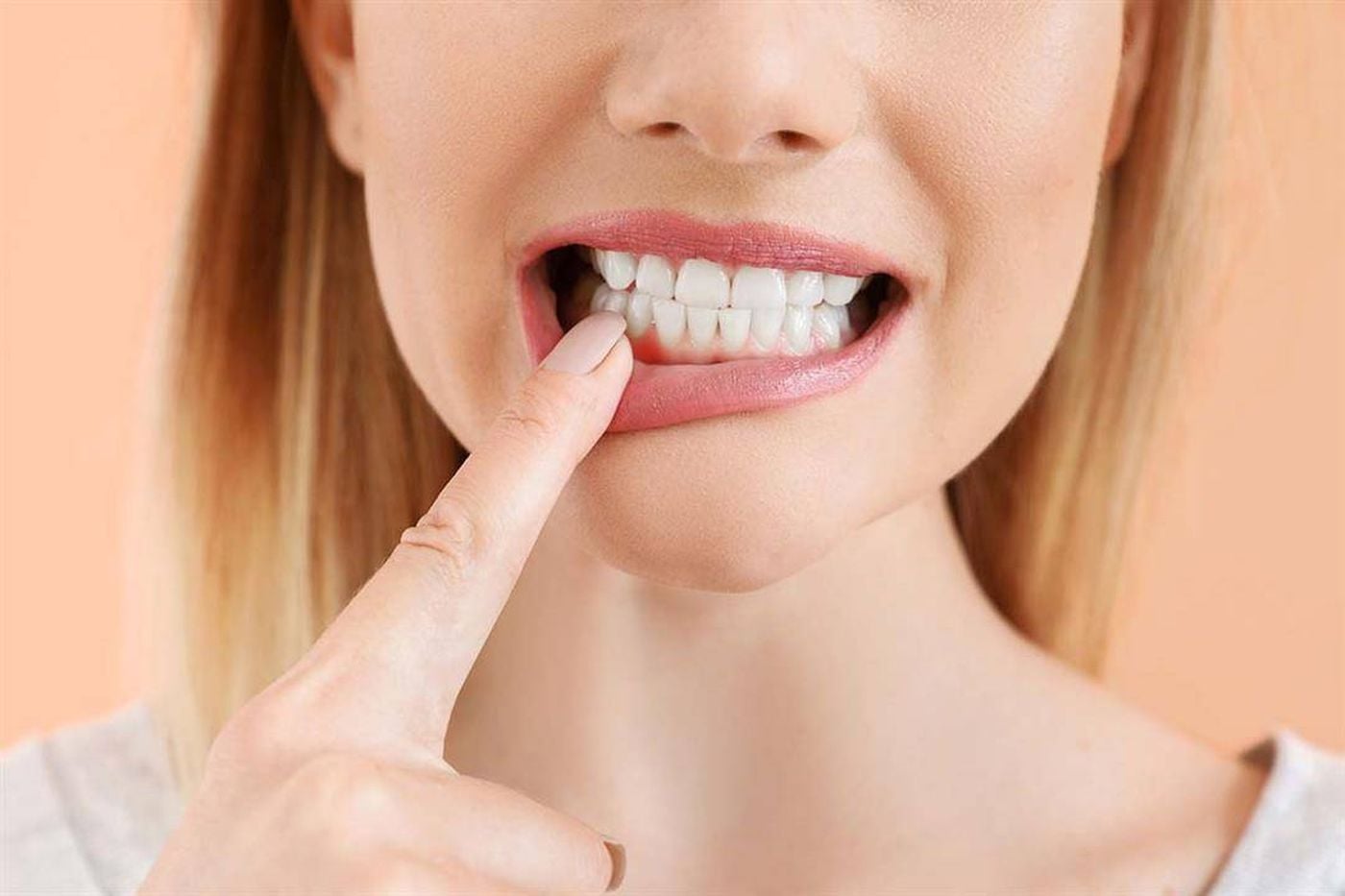 أسباب انحسار اللثة.. كيف نتجنبها؟