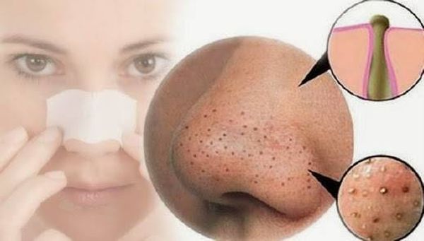 ضعي الملح والحامض على أنفك ثلاثة دقائق.. لن تصدقي النتيجة!