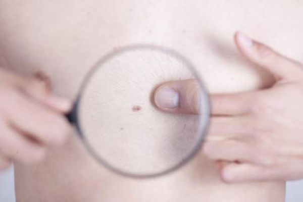 للرجال.. 10 أمراض خطيرة تهدد حياتكم إذ لم تقوموا بإجراء هذه الفحوصات!