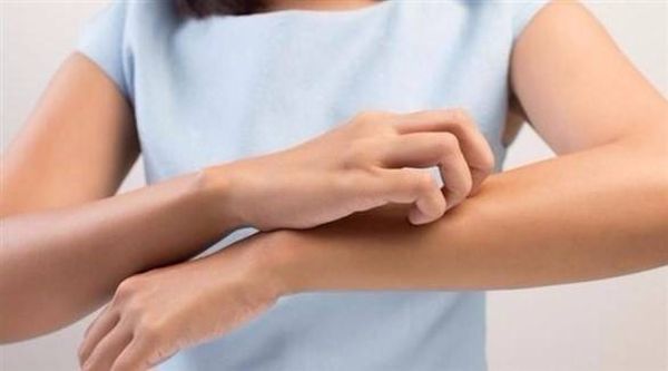 إذا شعرتم بحكّة في جسمكم إحذروا.. هذا ما تعنيه