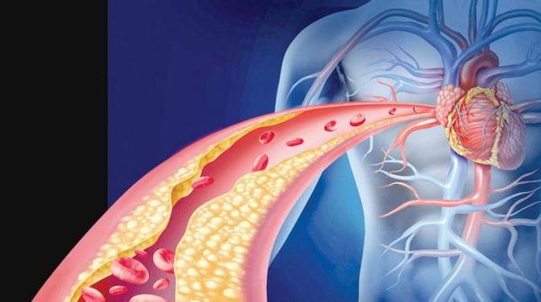 اليكم بعض المؤشرات لامكانية الاصابة بارتفاع نسبة 