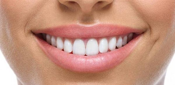 لون الأسنان... لماذا يتعيّر الى الأصفر؟