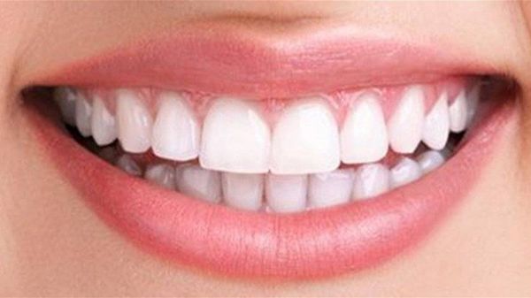 قوموا بهذه الخطوات السهلة... للحفاظ على صحة أسنانكم!
