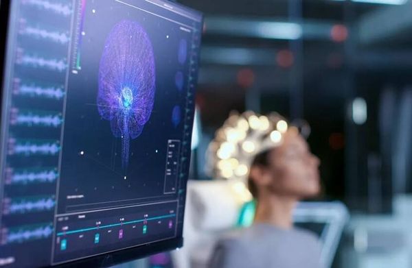 كيف نحمي أنفسنا من الزهايمر؟