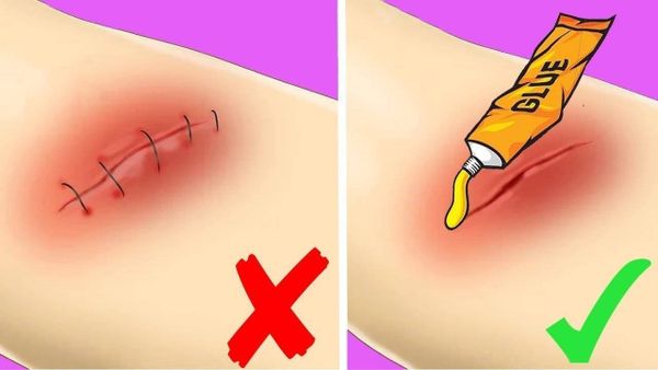 تعلم 7 حيل عبقرية قد تنقذ حياتك ذات يوم!