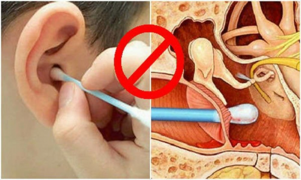 توقفوا عن استخدام أعواد تنظيف الأذن قبل أن تندموا!