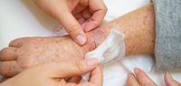 علاج مبتكر لشفاء جروح مرضى السكري!