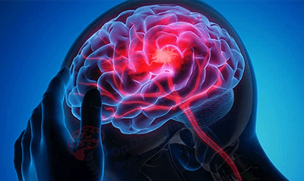 ‫هكذا تحافظ على شباب دماغك